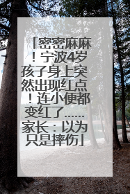 密密麻麻！宁波4岁孩子身上突然出现红点！连小便都变红了……家长：以为只是摔伤